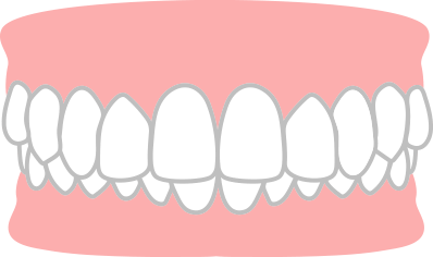 噛み合わせが深い